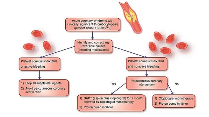 Thrombocytopenia-and-ACS.webp